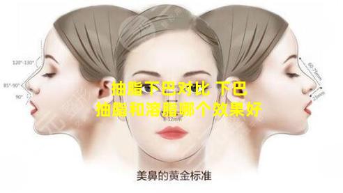 抽脂下巴对比 下巴抽脂和溶脂哪个效果好